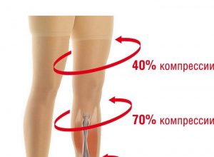 Изображение - News kompressionnye-kolgotki-pri-varikoze-kak-vybrat-razmer-300x220
